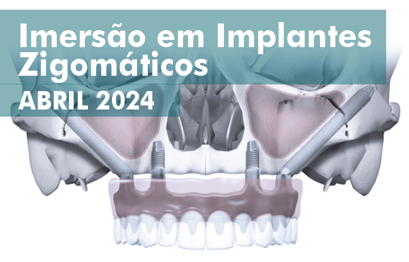 imersão implantes zigmaticos 2024