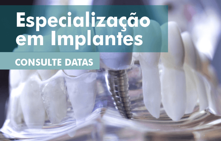 especializacao em implantes dentarios